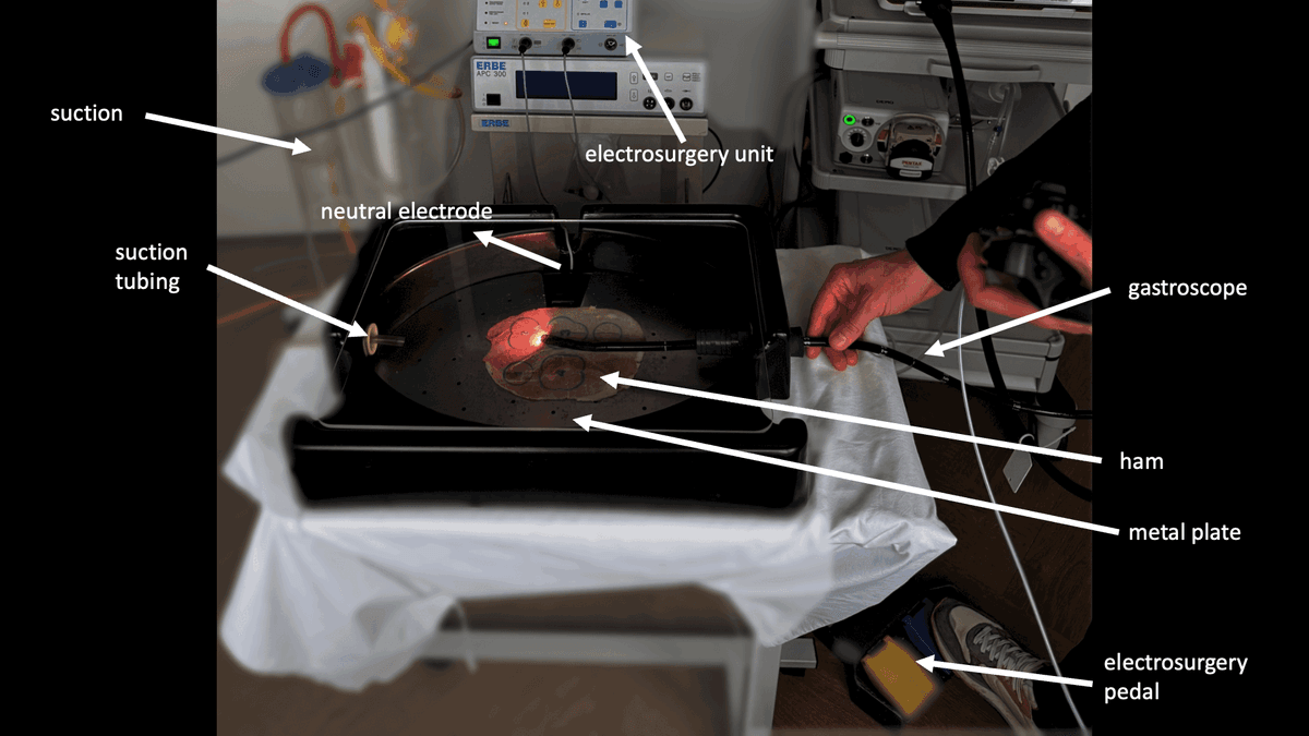 HAM Assessment Detailed View - Shows the snare tracing process and evaluation metrics