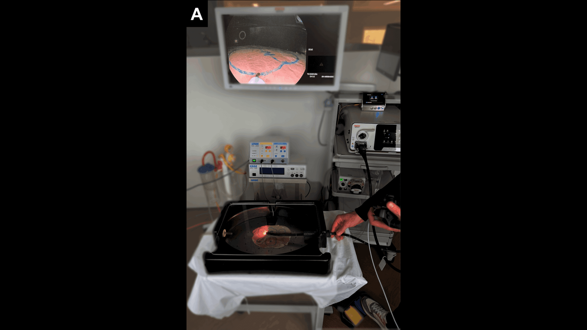 HAM Assessment System Overview - Complete setup showing training box, endoscope, ham medium, and assessment process